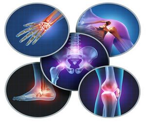 Vitamin D and Bone Health
